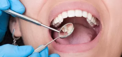 للحفاظ على صحة أسنانك.. 5 عادات خاطئة ابتعد عنه