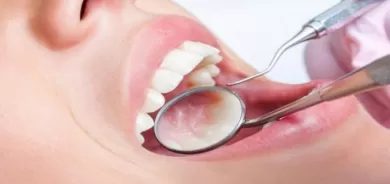 علامات في الفم تشير إلى أمراض خطيرة