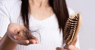 أسباب تساقط الشعر.. تحذير من اضطراب الهرمونات وسوء التغذية