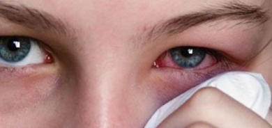 ما هو مرض رمد العيون؟