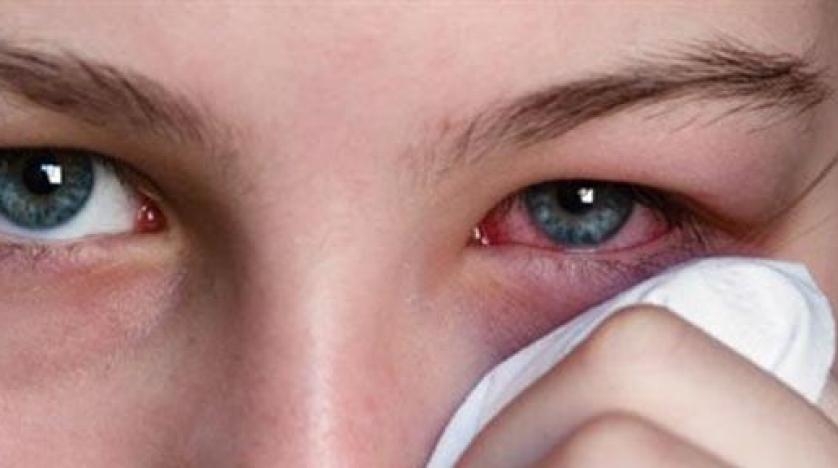 ما هو مرض رمد العيون؟