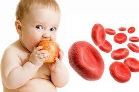 فقر دم الأطفال بسبب نقص الحديد... الأعراض والأسباب والعلاج