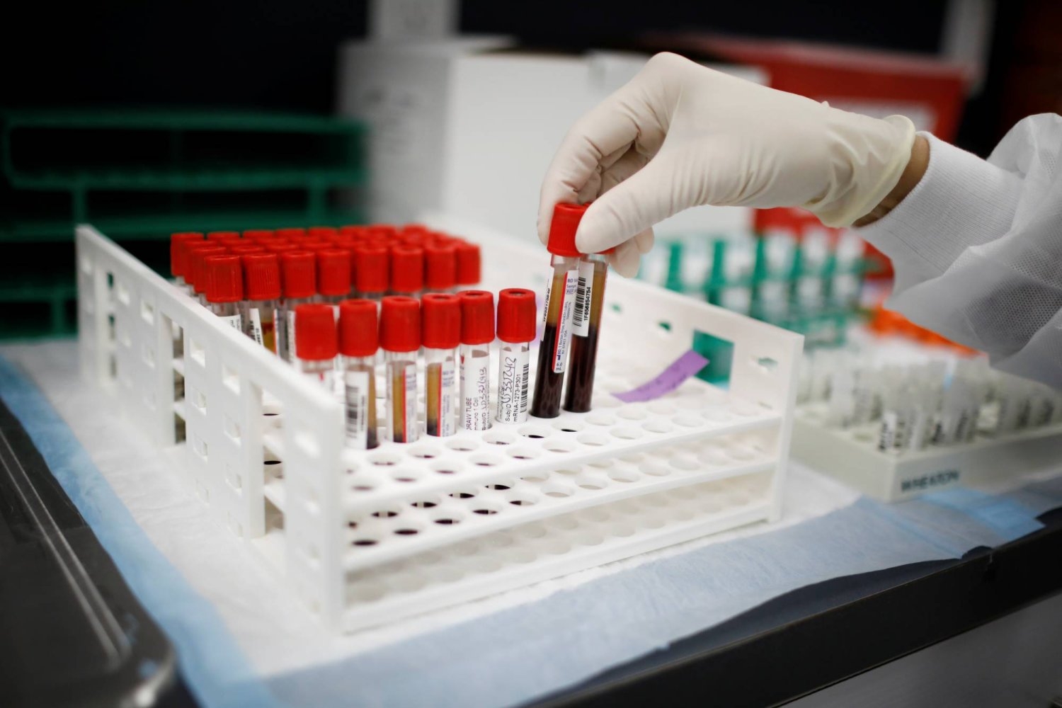 اختبار دم جديد يكشف العمر البيولوجي ويتنبأ بالإصابة بالأمراض !