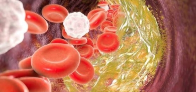 ما هو ارتفاع كوليسترول الدم الوراثي ؟
