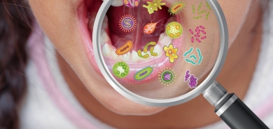 بكتيريا في الفم ترتبط بنحو 50 % من سرطانات القولون والمستقيم