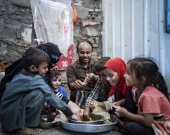 مخاوف أممية من اشتداد الجوع وسوء التغذية في اليمن