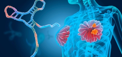 تسلسل الجينات الموروثة... دور حاسم في تحديد نوع وشدة سرطان الثدي