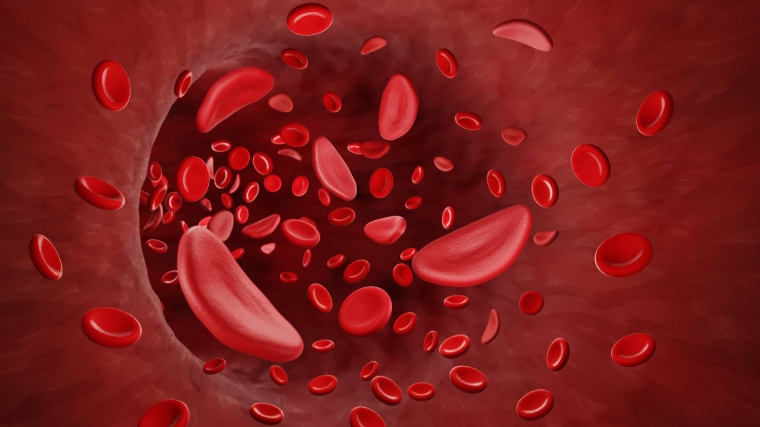 فقر الدم المنجلي... علاج جيني واعد وأبحاث على أدوية مطورة