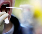 دراسة: بكتيريا الفم «تذيب» بعض أنواع السرطان