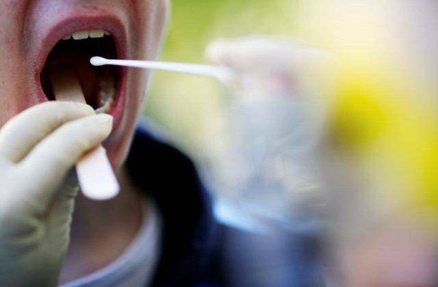 دراسة: بكتيريا الفم «تذيب» بعض أنواع السرطان