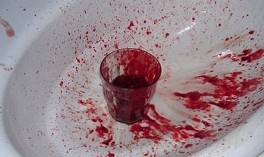 هندي يمتص دم زوجته يومياً لمدة 3 سنوات ليمنحه القوة