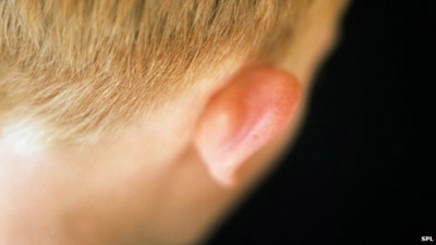 Great Ormond Street doctors aim to grow ears from fat