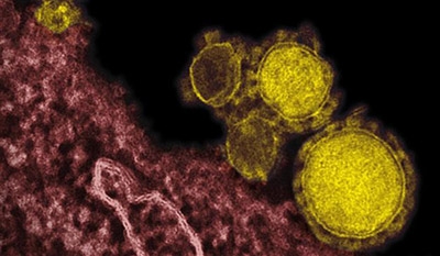 WHO to hold emergency talks on deadly MERS virus 