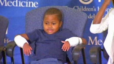 US boy becomes youngest recipient of double hand transplant
