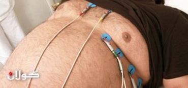Obese heart patients 'do better'