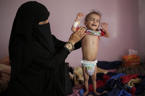 US resumes aid to Yemen’s rebel north as famine threatens