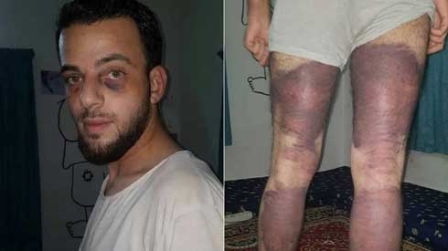 Syrian opposition activist tortured for taking pictures in Afrin